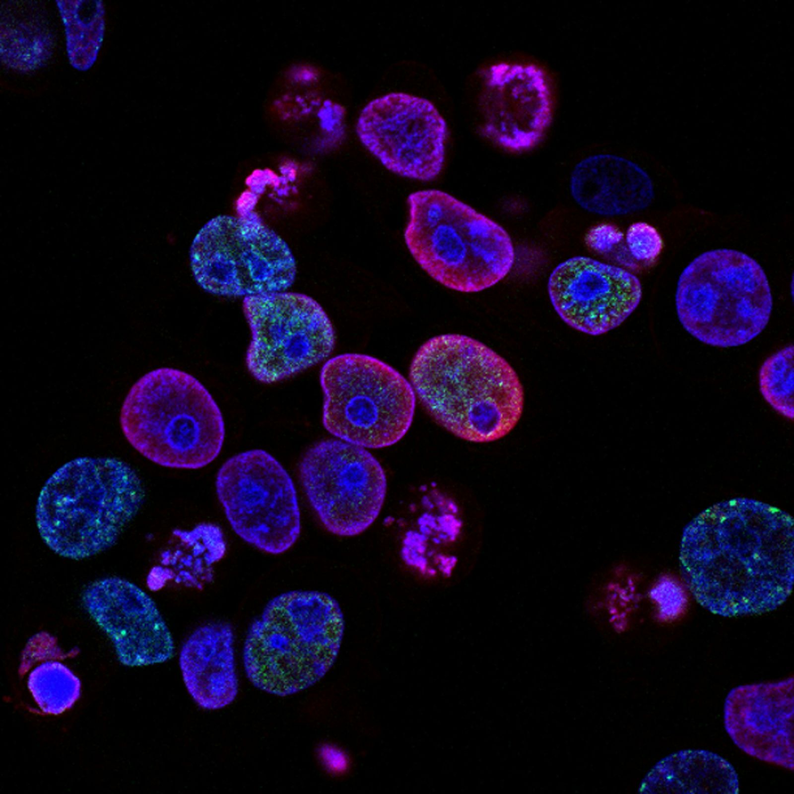 Cellules observées en microscopie de fluorescence, noyaux et cytoplasmes colorés