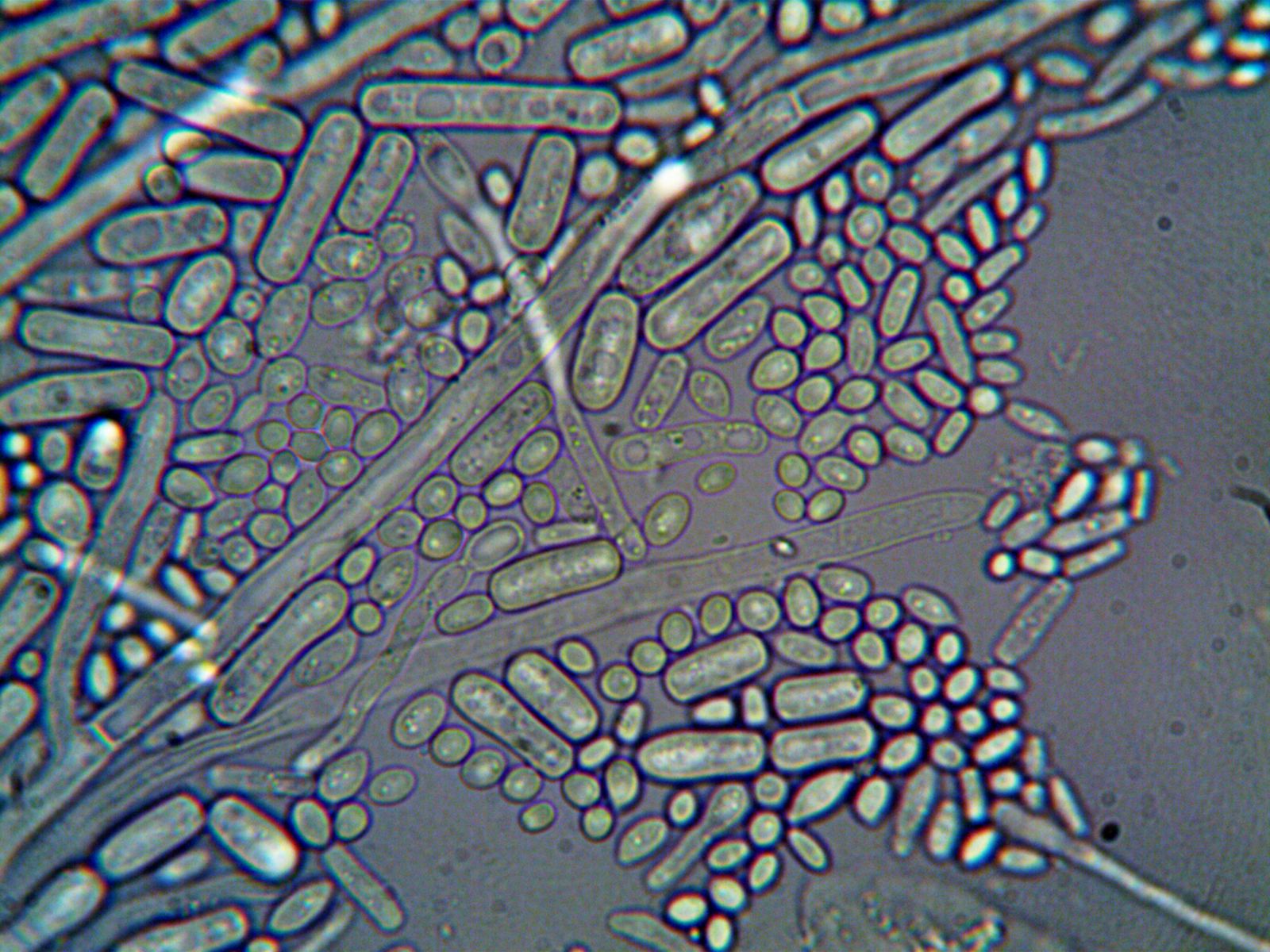 Observation en microscopie optique de micro-organismes en bâtonnets et de cellules rondes